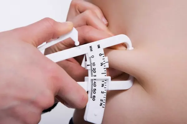 tratamento para obesidade e sobrepeso em Belo Horizonte